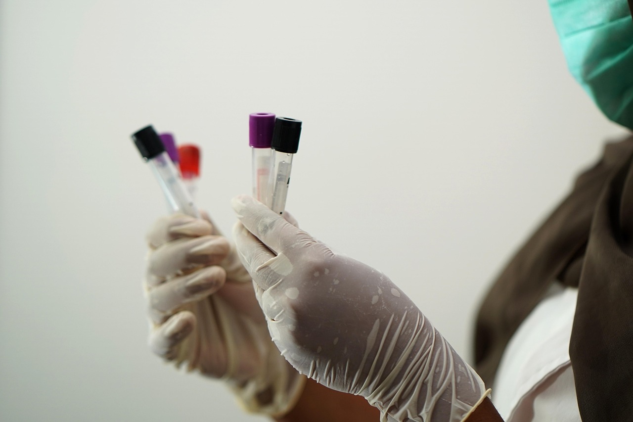 laboratory, test tubes, medical staff, researcher, coronavirus, pandemic, lab test, blood sample, blood specimen, test tubes, medical staff, medical staff, medical staff, medical staff, medical staff, lab test, blood sample, blood sample, blood sample, blood sample, blood sample
